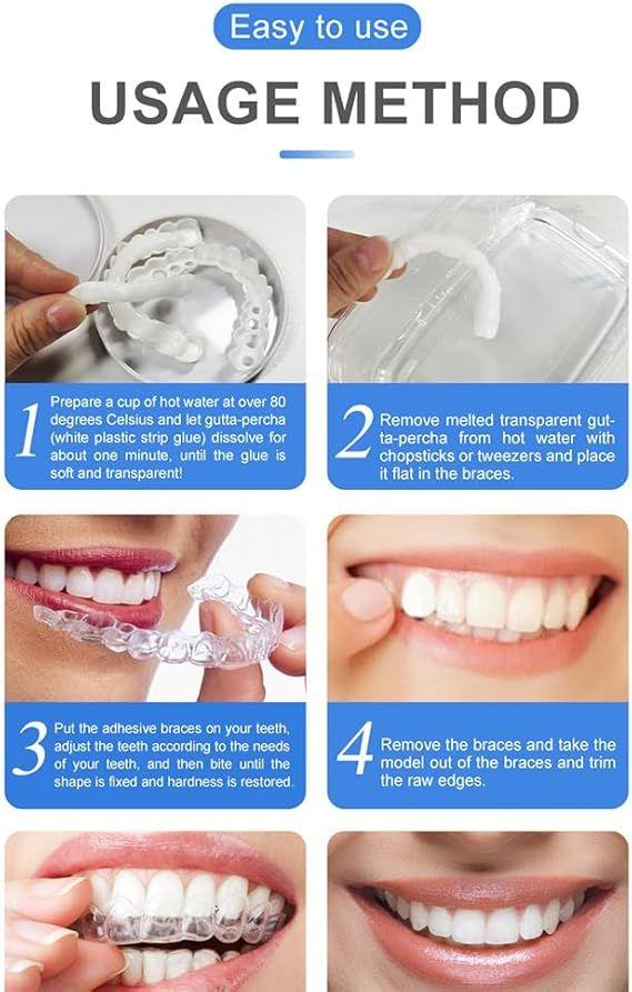Snap On Smile Veneers – Instant Fake Teeth Kit for Men & Women | Moldable Cosmetic Teeth