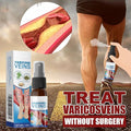 Best Varicose Vein Spray for Leg Relief – Herbal Cooling & Soothing Care