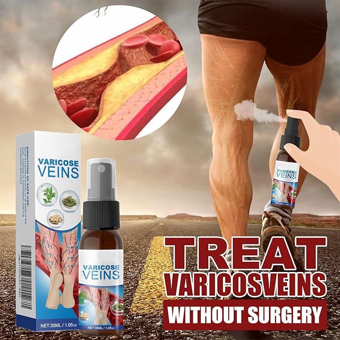 Best Varicose Vein Spray for Leg Relief – Herbal Cooling & Soothing Care